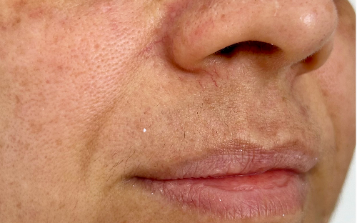 Preenchimento Bigode chinês