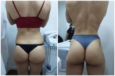 Bumbum