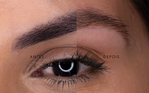 Correção de micropigmentação