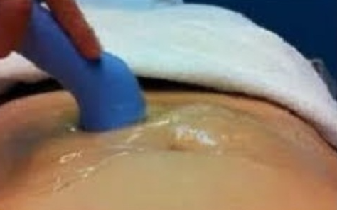 Lipocavitacao