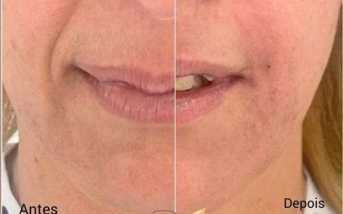 Preenchimento Bigode chinês