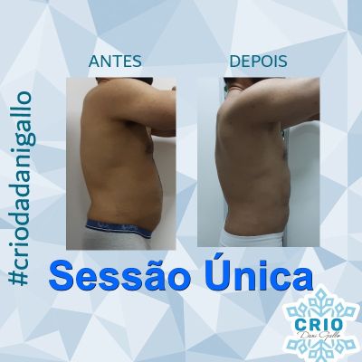 Harmonização Corporal Masculina